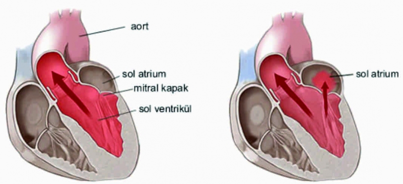 Kalbin içindeki mucize: Mitral kapak