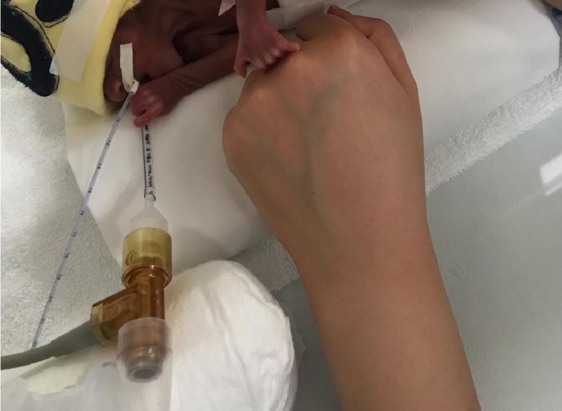 Kalbinin attığını görünce hayata bağlandım