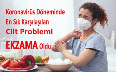 En Sık Karşılaşılan Cilt Problemi Ekzama Oldu