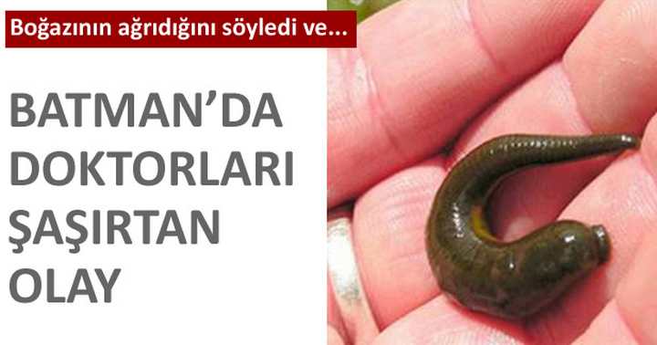 Boğazından sülük çıktı
