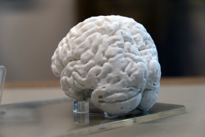 “Türkiye’de ilk kez yaşayan bir insan beyninin 3D kopyası yapıldı”